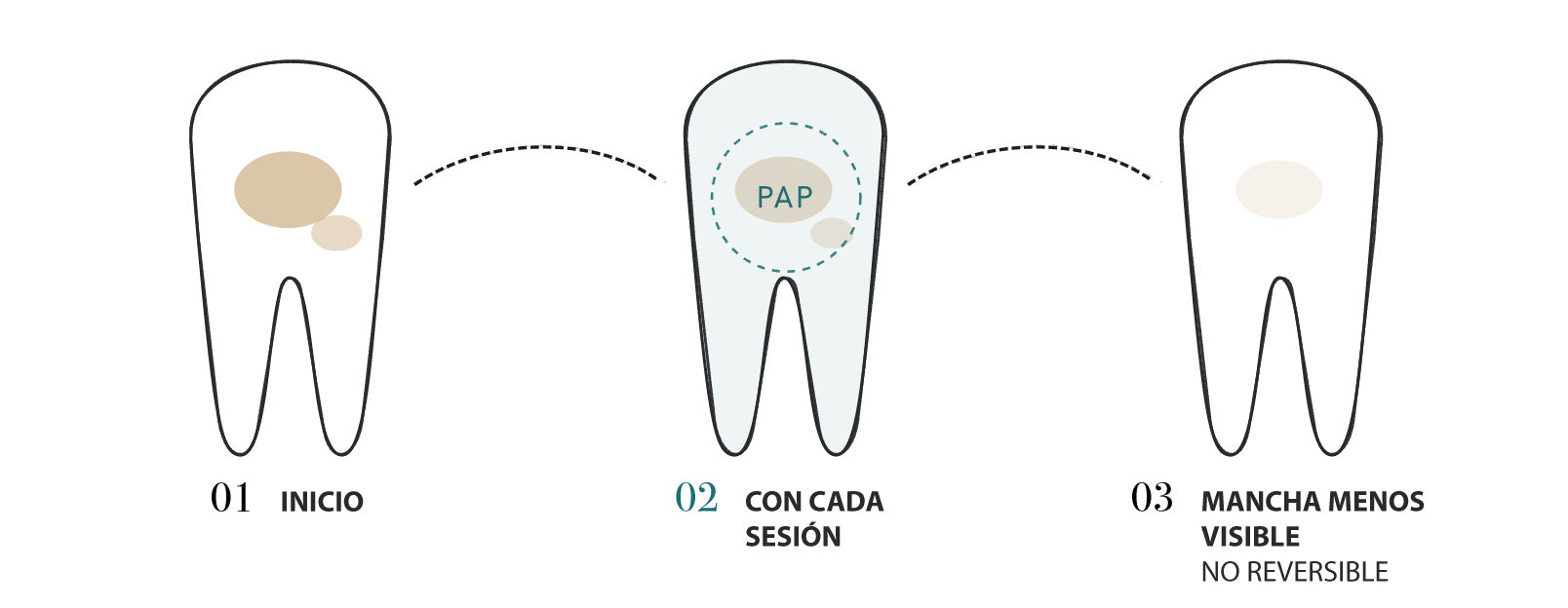 BLANQUEAMIENTO CON PAP